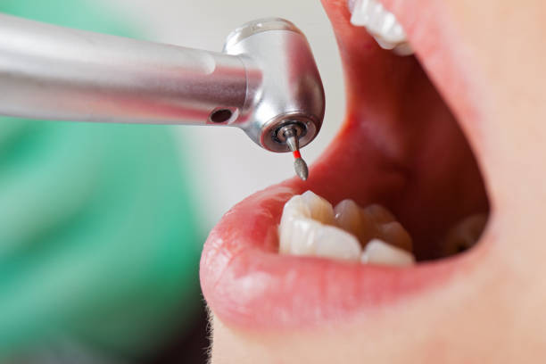 Best Broken Tooth Emergency  in Cedar Grove, FL